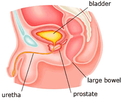 Plaats van de prostaat